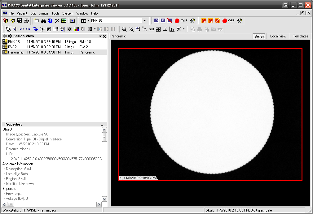 Image of MiPACS of an object with unknown length