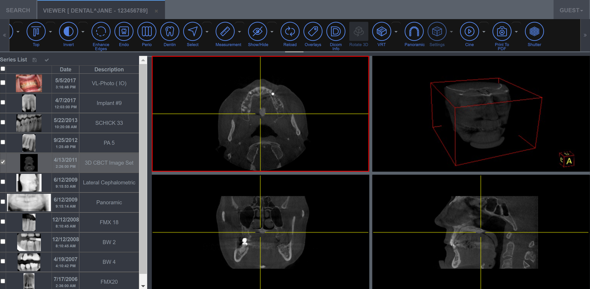 MiPACS Html Viewer 2