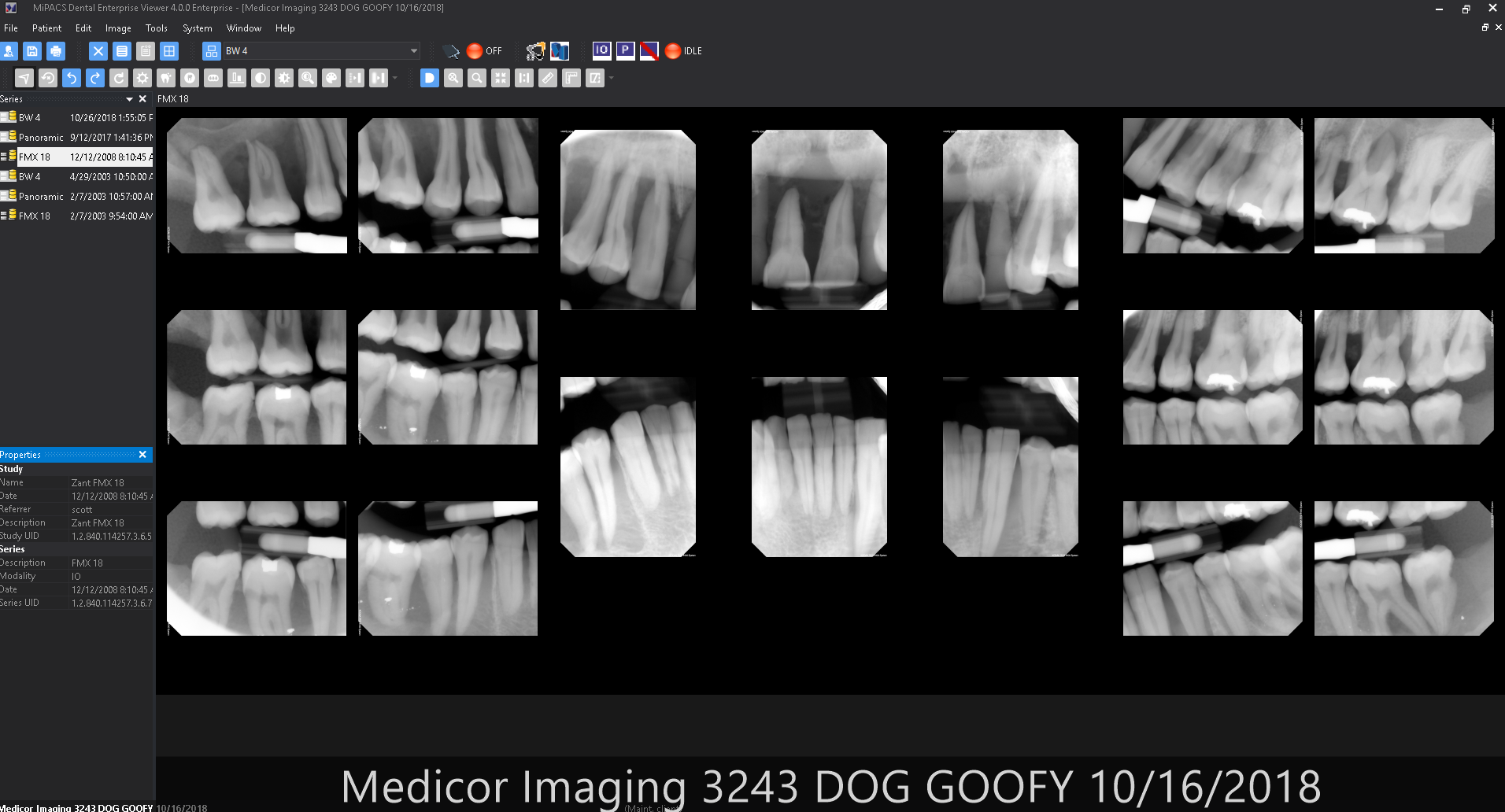 Image of MiPACS showing how format can be changed of paitent information with version 3.2.2 or higher